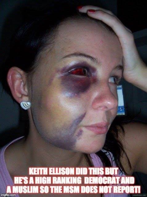 Ellison's beaten girl friend